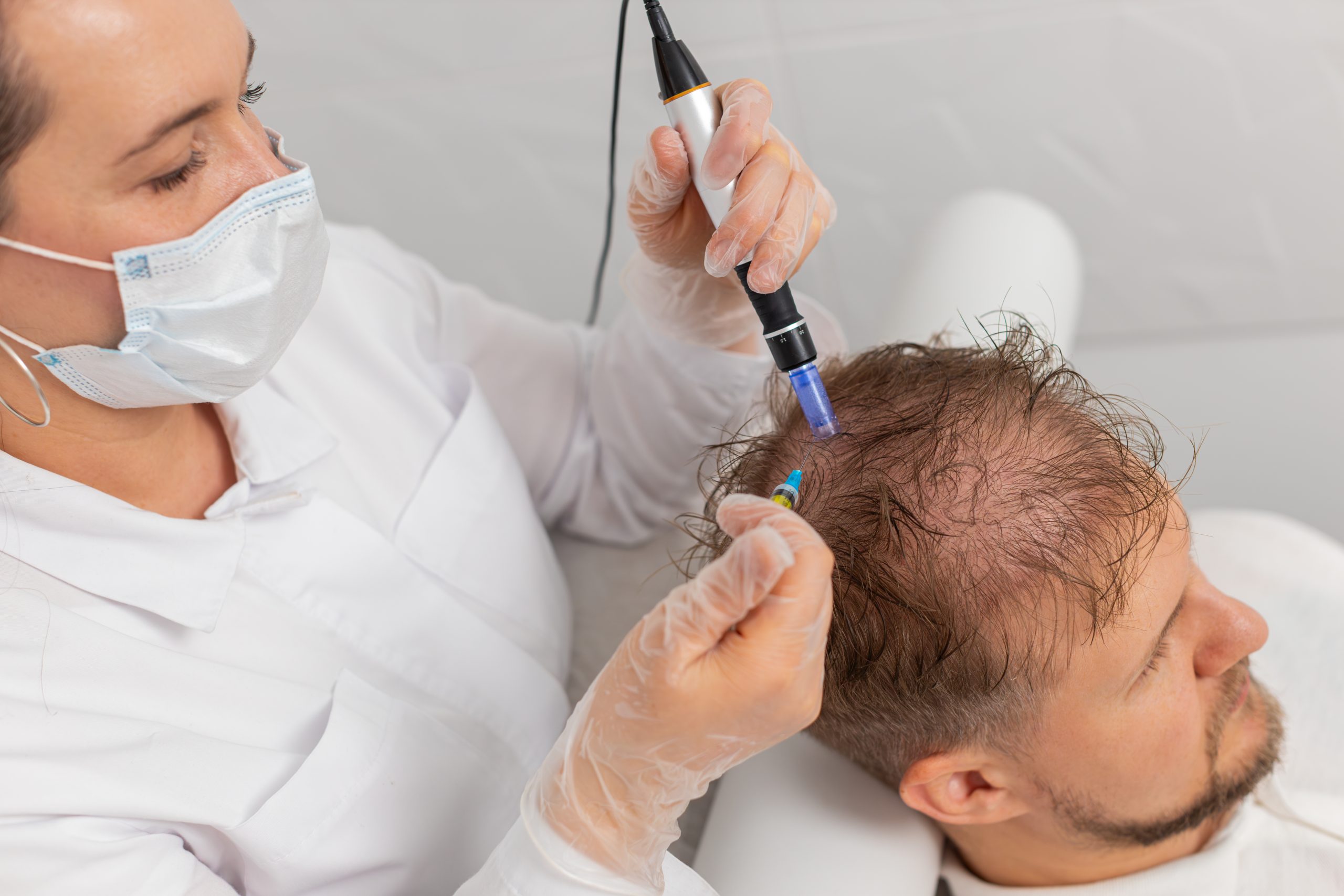 ¿Por qué se me cae el cabello? Guía Médica con Posibles Causas, Alopecia, Prevención y Exosomas¿Por qué se me cae el cabello? Guía Médica con Posibles Causas, Alopecia, Prevención y Exosomas